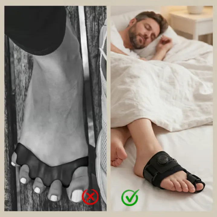 Before and After